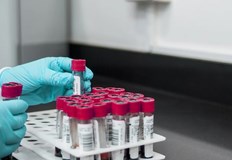 В Русе новооткритите случаи са 611864 са новите случаи на