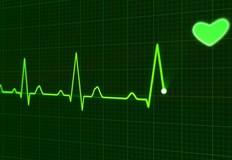 Пулсът показва броя удари на сърцето за единица времеВсички знаем