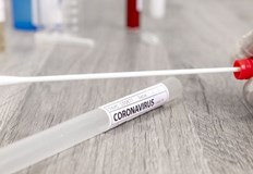 411 са новите случаи на коронавирус у насПоложителни са 24 от