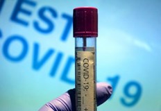 1087 са новите случаи на коронавирус у нас за последните 24