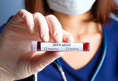 1403 са новите случаи на коронавирус потвърдени при направени 7