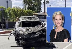 Актрисата остава в кома и е получила тежка аноксична мозъчна