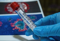 Хиляда пациенти са настанени в болница От тях 59 са в