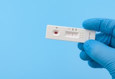 189 са новите случаи на коронавирус у нас за последните