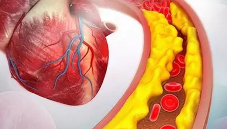 Холестеролът е едно от важните вещества в нашето тяло, което бива синтезирано и от организма ни, но и си го набавяме с храната, която консумираме