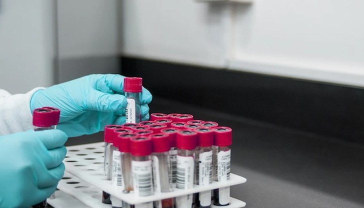 В Русе новозаразените са 61 В Русе новозаразените са 61