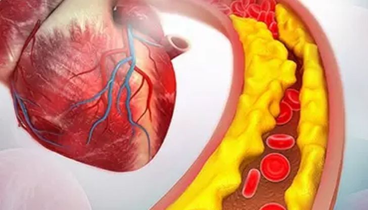 В българския разговорен език холестеролът бива разделян на добър и на лош,
