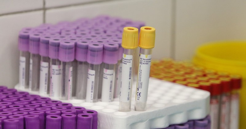 В болници се лекуват 1084 души2318 са новите заразени с