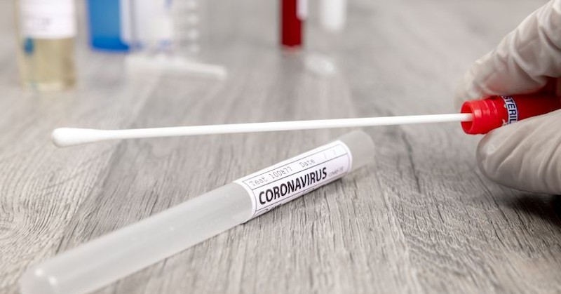 411 са новите случаи на коронавирус у насПоложителни са 24%