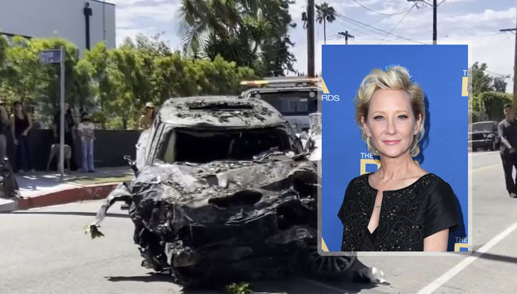 Актрисата остава в кома и е получила "тежка аноксична мозъчна