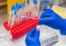 Намаляват случаите на коронавирусТочно 777 са новорегистрираните случаи на коронавирус