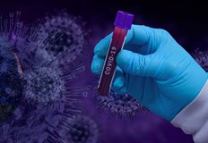 1127 са новите случаи на коронавирус в БългарияТова са 14 91