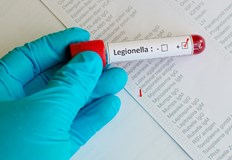 Откриха от какво е причинена пневмонията отнела човешки животи в