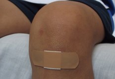 В много от случаите остават и белезиТютюнопушенето и вредите от