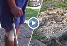 Русенец пострада сериозно заради разбит тротоарМъжът паднал докато отивал на работа