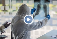 Ръст на случаите на туберкулоза у нас отчитат лечебни заведенияСпоред