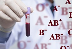 Хората с ранен инсулт е по вероятно да имат кръвна група