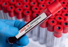 Активните случаи към 7 и септември са 12 008 заразениУ нас през