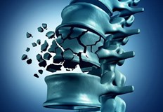 Използваният метод е показан предимно при жени с остеопороза и