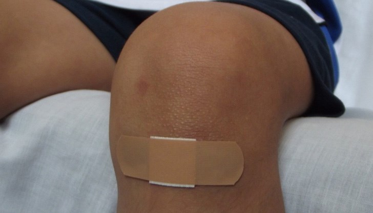 В много от случаите остават и белези