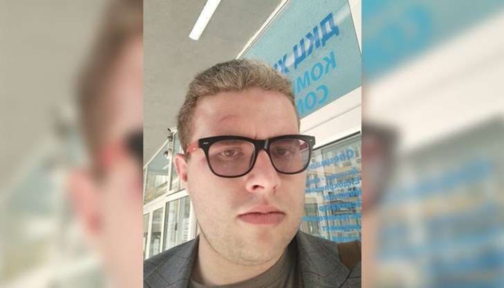Никола Попстоев се оплака, че е нападнат и бит в квартал "Лозенец"