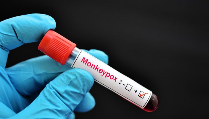 Заболелият е на 39 г. с характерен обрив по тялото, в добро общо състояние Заболелият е на 39 г. с характерен обрив по тялото, в добро общо състояние