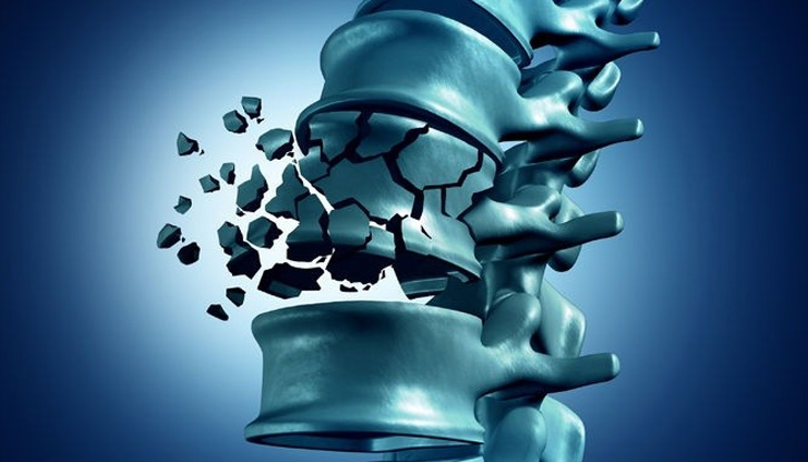 Използваният метод е показан предимно при жени с остеопороза и