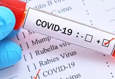 Въпреки това американците все по малко се притесняват от пандемиятаПравителството на