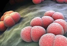 Има и смъртен случай от ентероколит152 ма души от Варненска област