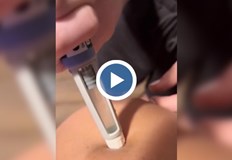 В социалните мрежи е пълно с клипове показващи прилагане дори