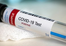 Лек спад на процента нови заразени от COVID 19Новите потвърдени случаи