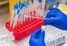 Няма починали от коронавирус за последното денонощие121 са новите случаи