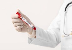 Става дума за мъж на 44 години от БукурещМинистерството на