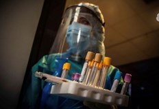 В болници за лечение остават близо 700 пациенти665 са новите случаи