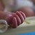 Лекари спасиха недоносено бебе с вродена малформация, тежащо едва килограм Лекари спасиха недоносено бебе с вродена малформация, тежащо едва килограм
