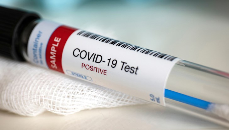 Лек спад на процента нови заразени от COVID-19