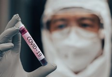Дневният брой на заразени с коронавирус в страната достигна 31