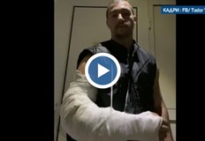 На пострадалия е извършена операция на лакътя и той все още е