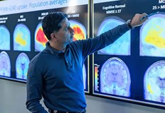 Ново лекарство забавя развитието на болесттаНово лекарство срещу Алцхаймер дава