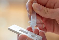 През последното денонощие са били излекувани 624 душиПри направените 5