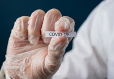 За цялата страна случаите на новозаразени с коронавирус са 77 Броят