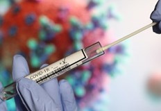 210 са новите случаи на коронавирус у нас за изминалото