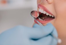 Почти половината от населението на света страда от болести на устната