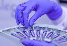 В болници за лечение остават 495 пациенти220 са новите случаи на