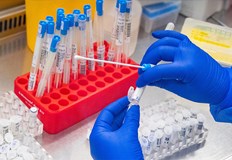 Страната е на второ място в света по смъртност от