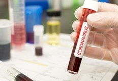 Само 10 от направените тестове за COVID 19 за денонощието са