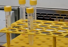 Излекувани през последното денонощие са 1071 душиНовите потвърдени случаи на коронавирус у нас