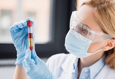 Направени са 5126 теста от които 9 1 са положителниЗа изминалото денонощие