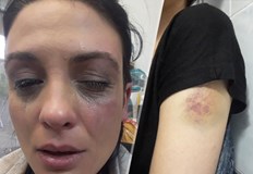 Актрисата Диана Димитрова е поредната жертва на насилие останало ненаказаноТова