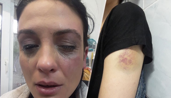 Актрисата Диана Димитрова е поредната жертва на насилие, останало ненаказано Актрисата Диана Димитрова е поредната жертва на насилие, останало ненаказано